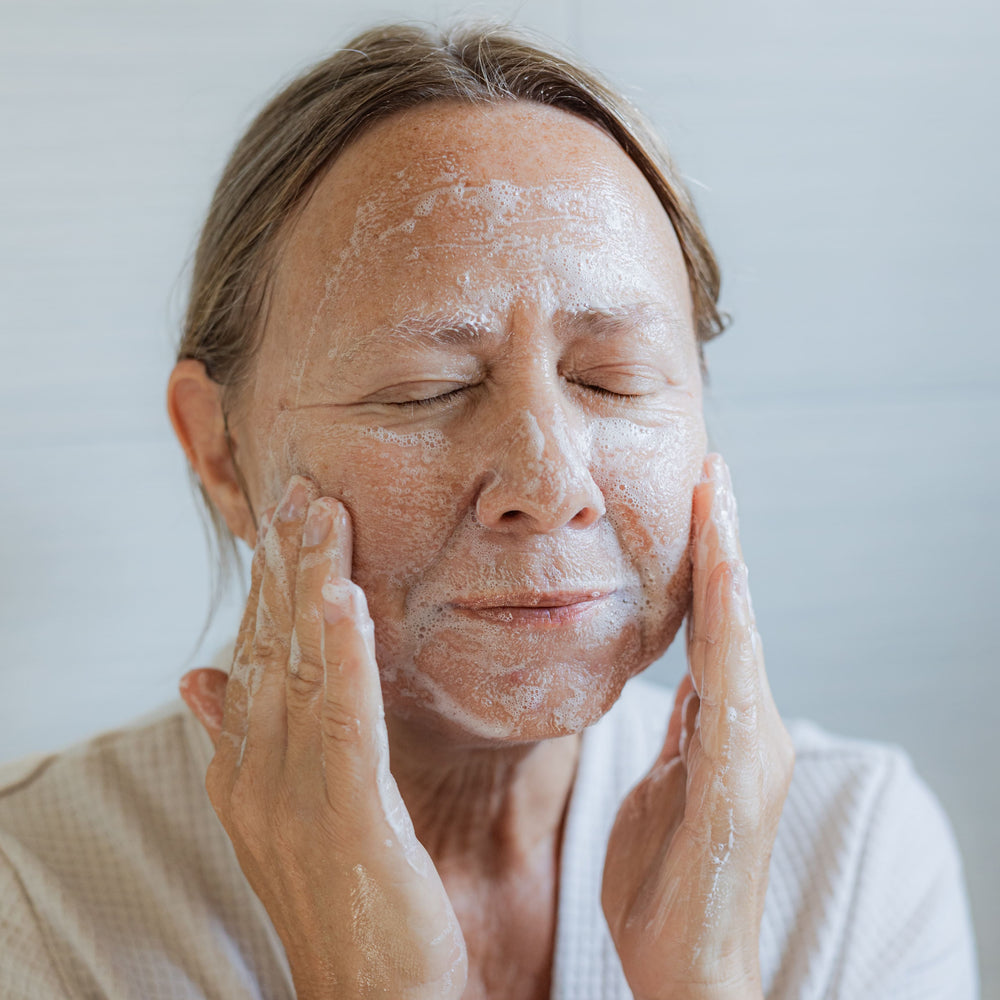 Natural Skincare For Rosacea